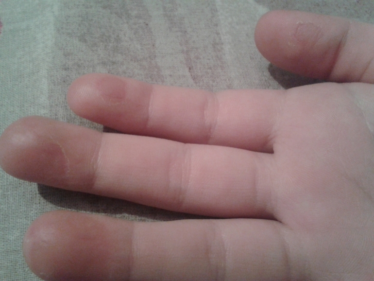 что это может быть