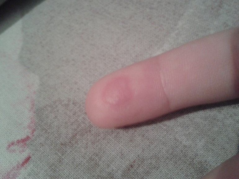 что это может быть