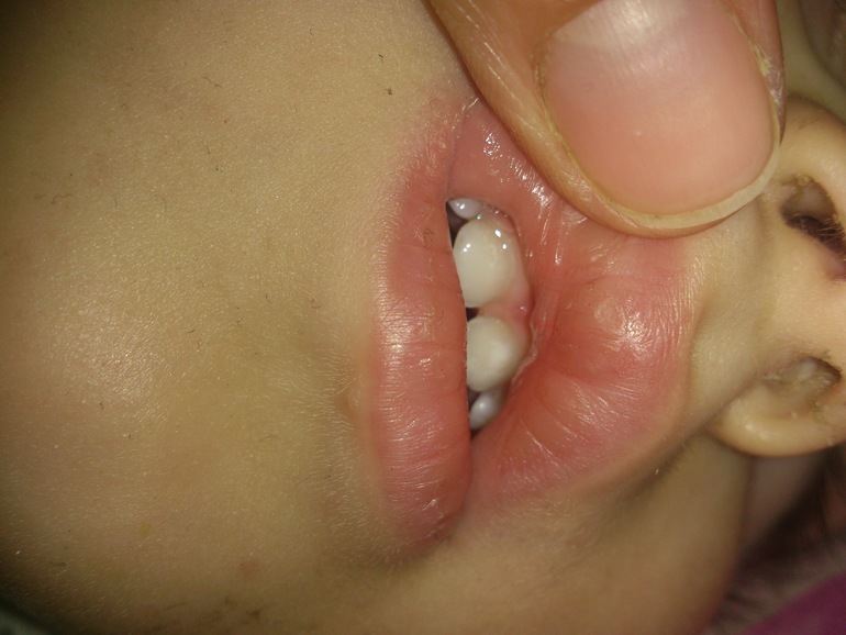 врачи у нас в городе за нас не берутся, что делать