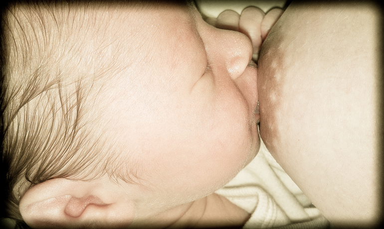 Застой молока и мастит